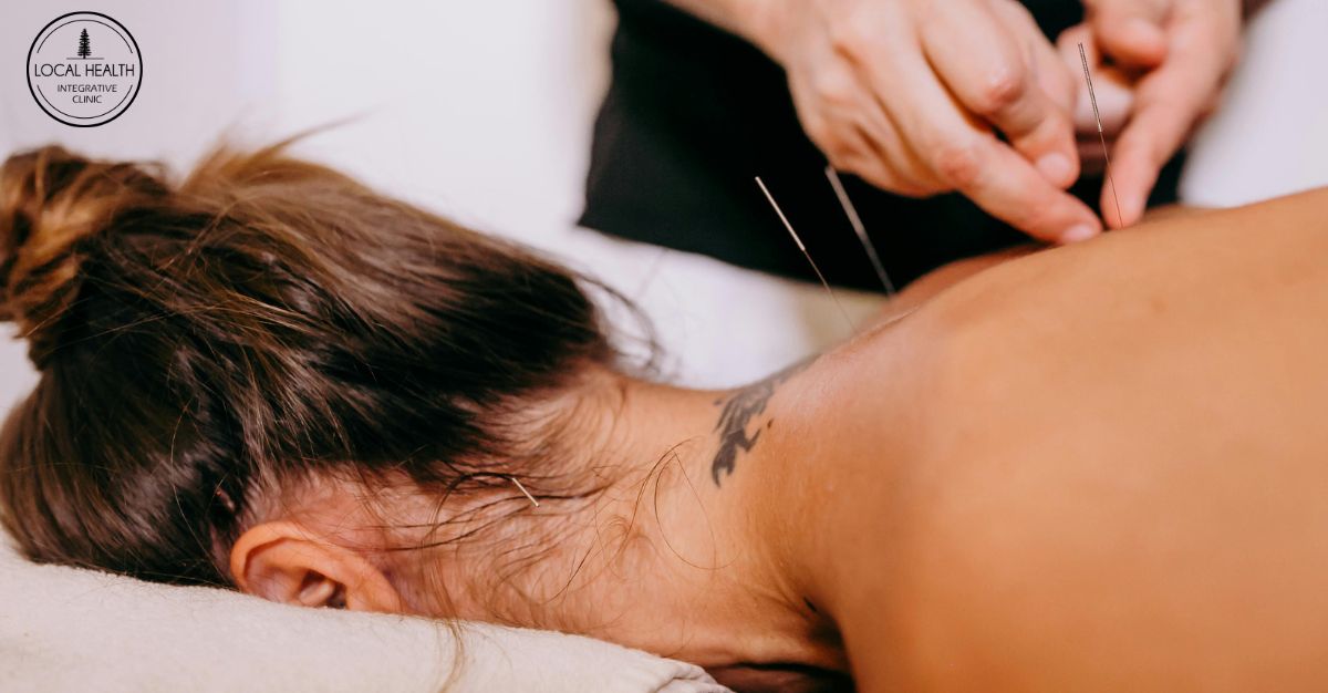 A person receiving acupuncture